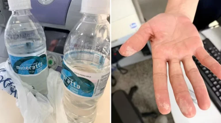 Laudo detecta ácido em garrafas de água após internação em SP Foto: Polícia Civil de Garça/reprodução