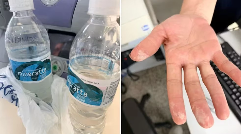 Laudo detecta ácido em garrafas de água após internação em SP Foto: Polícia Civil de Garça/reprodução